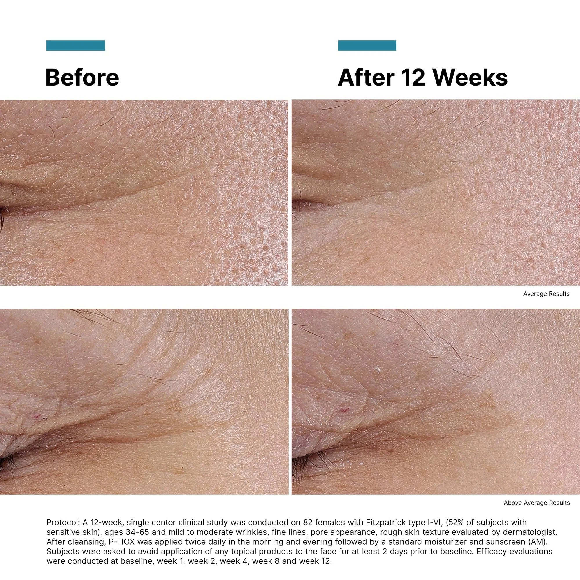 SkinCeuticals P-Tiox (3 Pack)